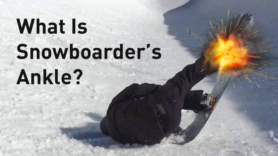 snowboarders-ankle-cover-2